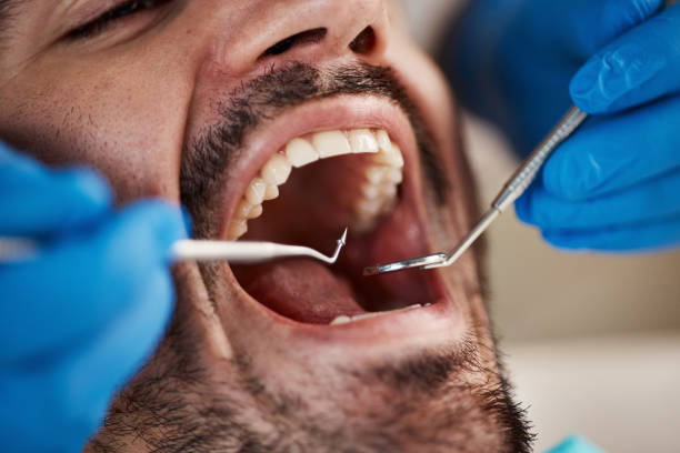 Best Emergency Dental Services for Seniors in Fairfield, AL