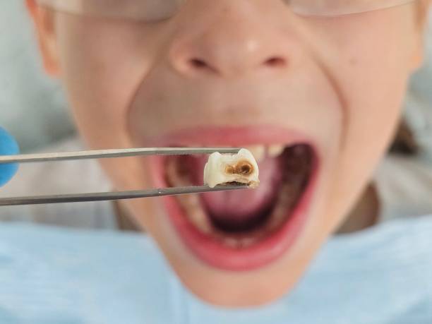 Best Pediatric Emergency Dentist in Fairfield, AL